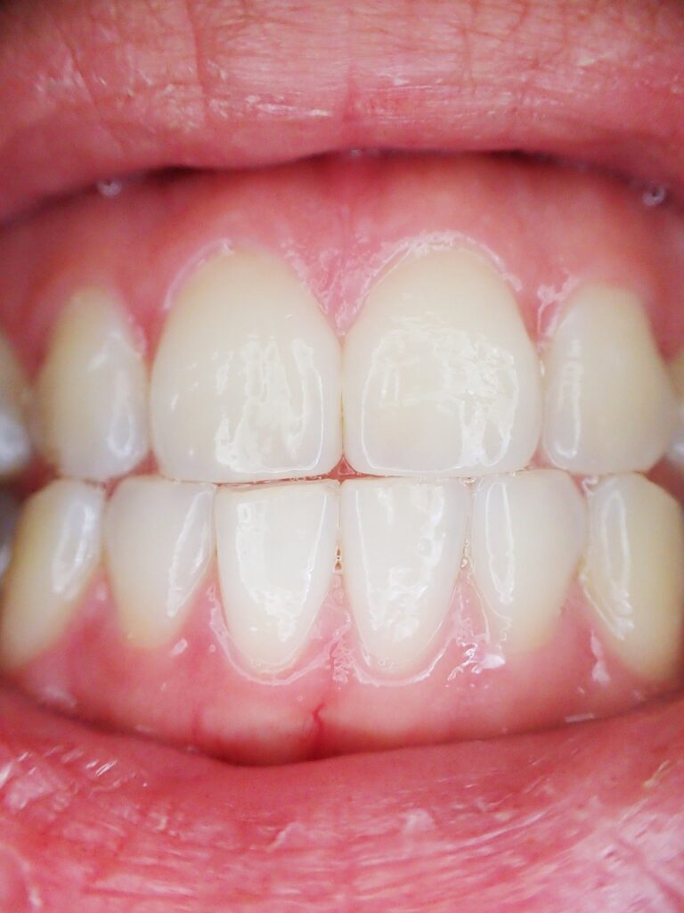 teeth-887338_1280